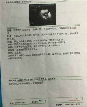 什么鬼医院手术做一半无肿瘤还是市人民医院哦